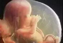 羊水为什么叫羊水秒懂知识,12周羊水什么样子