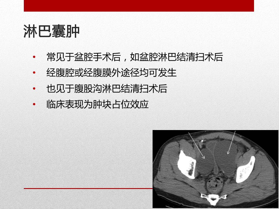 「图文+语音」刘明|泌尿外科腹腔镜手术并发症的术中及术后处理