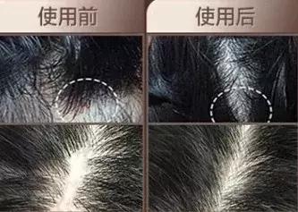 戴森卷发棒好用吗,买了戴森卷发棒有必要买吹风机吗