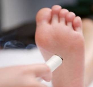 灸艾灸会不会引起上火,艾灸上火了需灸哪个穴位降火