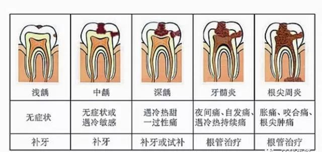 牙疼不是病痛起来要人命图片,牙疼不是病疼得要人命