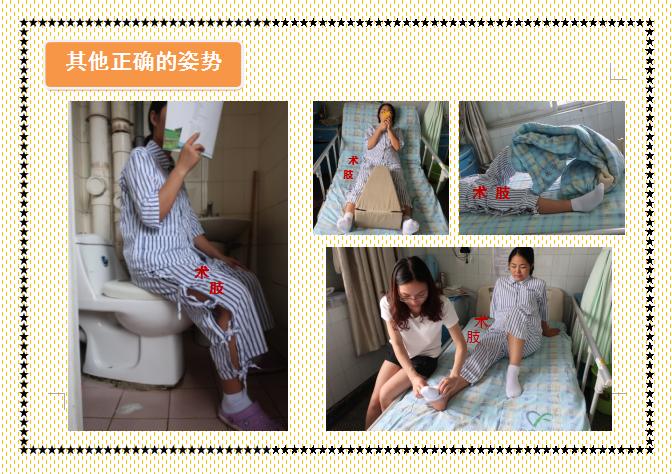 人工髋关节置换术前准备护理,人工髋关节置换术的健康宣教手册