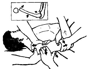 中医骨折治疗原则,中医骨伤整复术