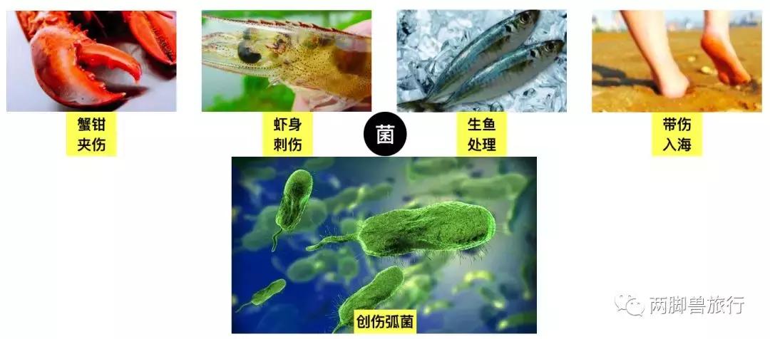 朋友潜水被蛰了，这回我没有用尿救她