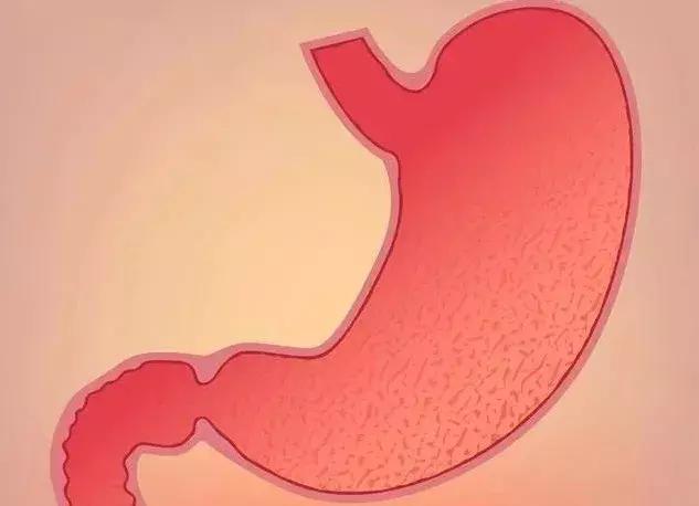 检查出非萎缩性胃炎,病理诊断慢性非萎缩性胃炎轻度