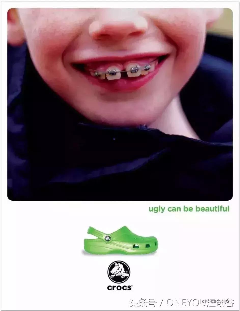 crocs洞洞鞋鞋面折损,crocs洞洞鞋有必要买吗