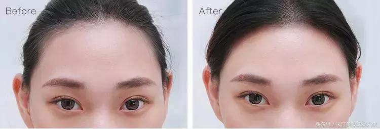 浣犺繕鍦ㄤ负浜嗚劚鍙戠儲鎭煎悧,浣犺繕鍦ㄤ负浣犺劚鍙戠儲鎭艰嚜鍗戝悧