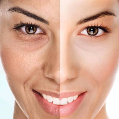 玻尿酸吸收后会有什么变化,打玻尿酸下巴5年后的变化