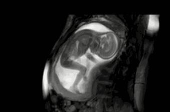 22周胎儿在肚子里的视频,22周胎儿在腹中真实照片