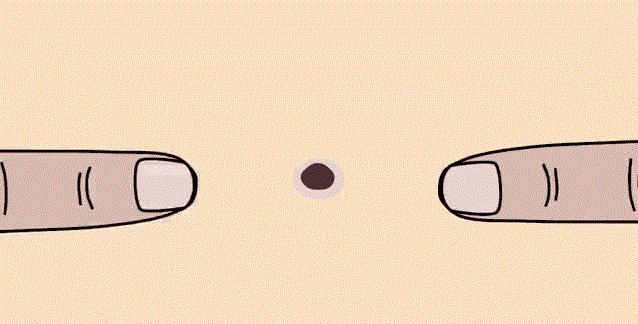 去黑头小妙招超全去黑头方法汇总,怎么正确去黑头并消除黑头