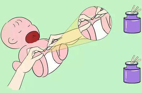 宝宝脐疝要怎么处理,儿子8岁了脐疝要动手术么