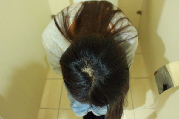 肛门总是痒痒上什么药,肛门总是痒痒用什么药