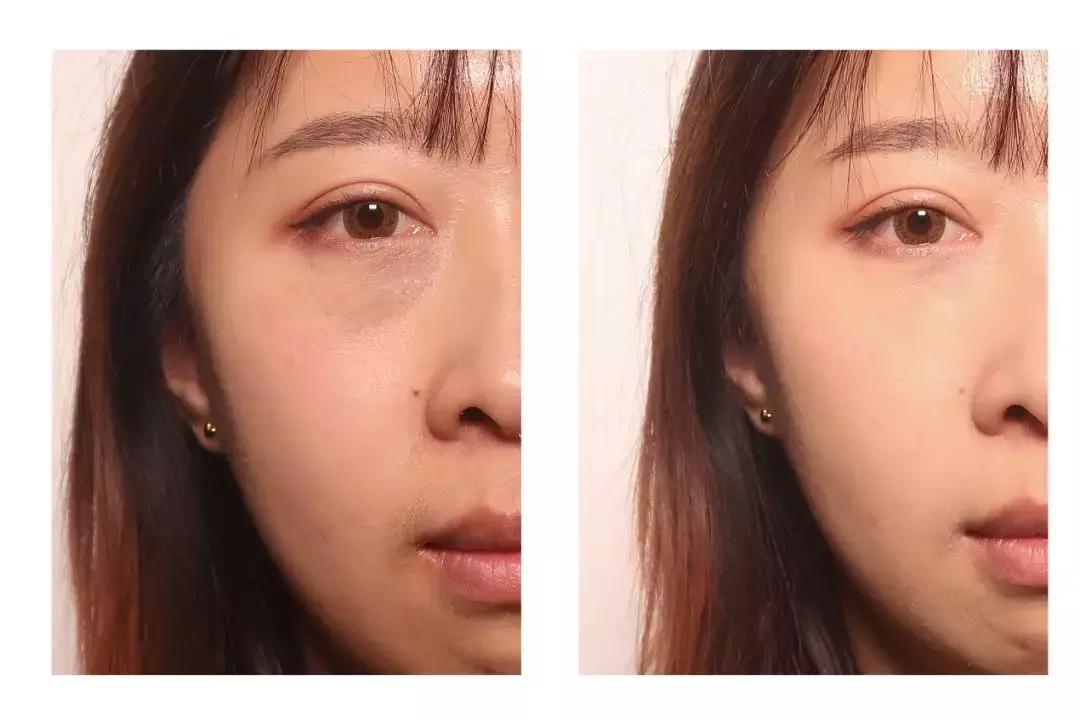 缇庡鐨偆绠＄悊鍖栧,缇庡闄㈠仛鑲岃偆閬憰