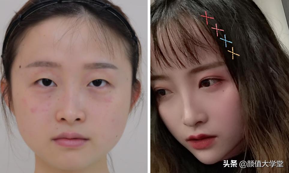 眼睛无神呆滞不灵活,眼睛无神呆滞精神涣散