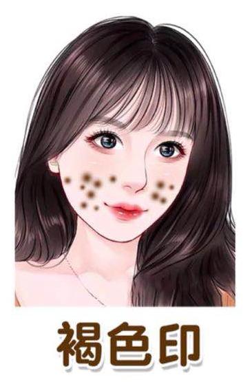 快速淡化痘印又简单的方法,怎样有效祛除痘印痘坑物理方法