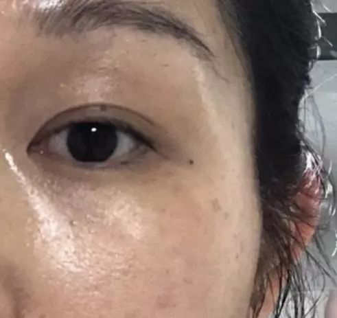 火到断货的“明星级”点斑笔,坚持每天点一下,14天养成初恋脸