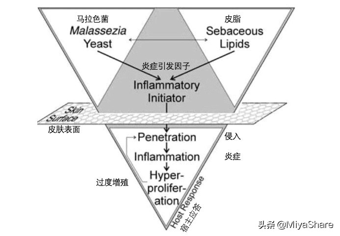 秋冬怎么减少头屑,头屑多的像下雪怎么洗