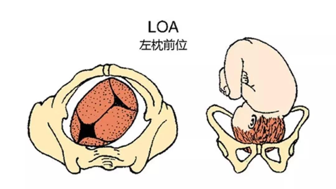 B超单的秘密，你看懂了？
