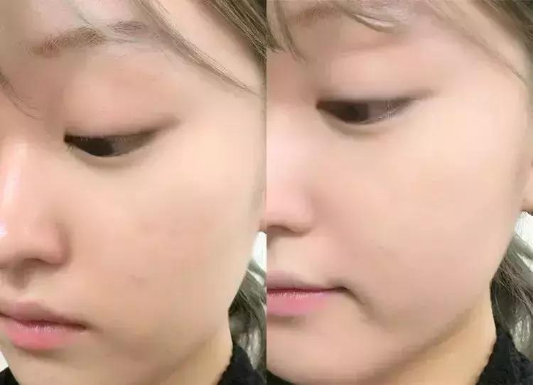 最好用的粉底气垫第一名,全世界最好用的大牌粉底