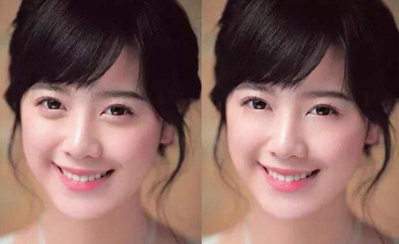 眼袋和卧蚕的区别教你区分小妙招,卧蚕和眼袋傻傻分不清的说说