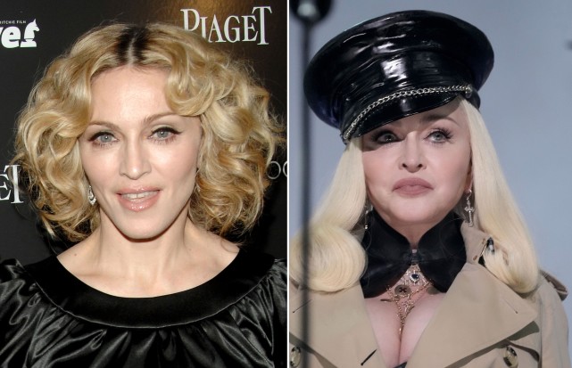 美国整形手术,整形医生提醒