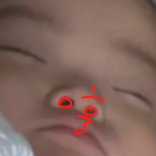 秋冬干敏修复,秋冬护肤干燥一定要选对精华