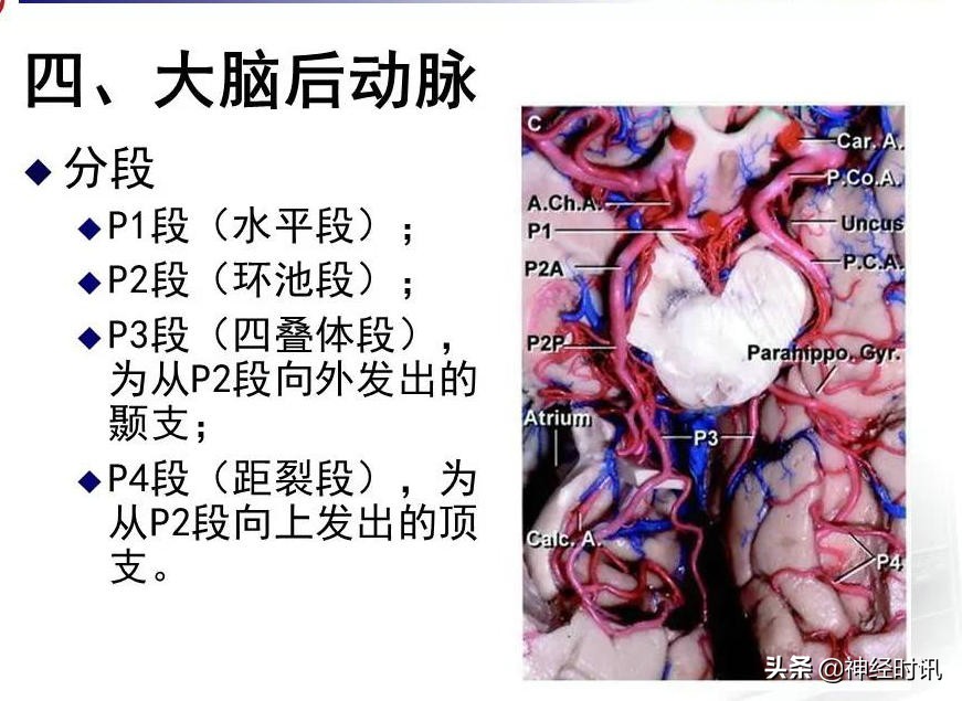 脑动脉解剖学讲解,基底节区脑血管解剖