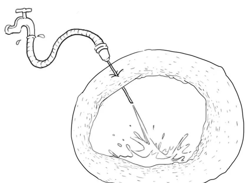 卵巢囊肿巧克力怎么形成的,卵巢长了巧克力囊肿是怎么回事