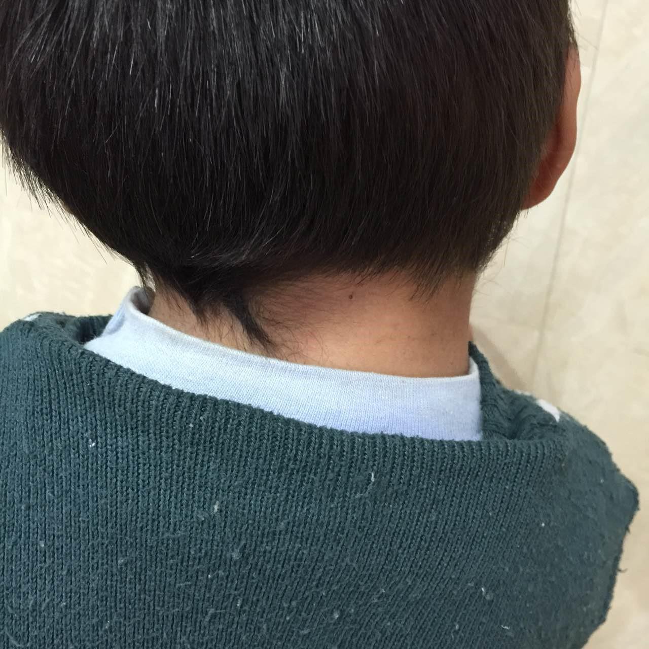 胸锁乳突肌病变痉挛时可引起斜颈,胸锁乳突肌和痉挛性斜颈有关系吗