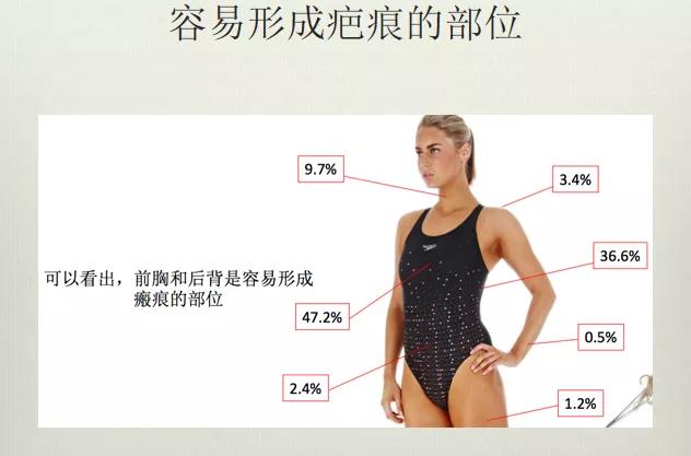 医美缝合的疤痕图片,医院用美容线缝合伤口多少钱