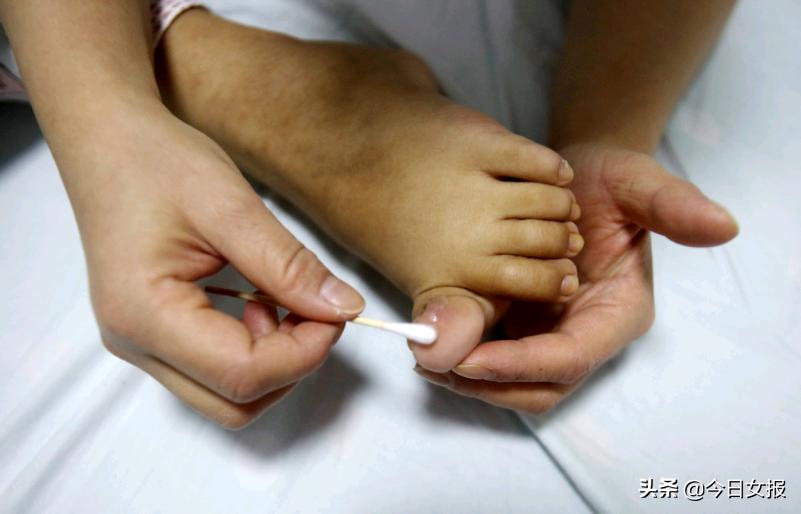 夫妻赚钱救自己的患白血病孩子,卖房救白血病妻子