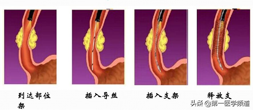 「医影传声」上海交通大学医学院附属瑞金医院卢湾分院放射科主任