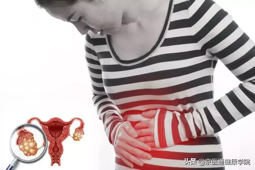 能治多种妇科病的药，却被人深深误解