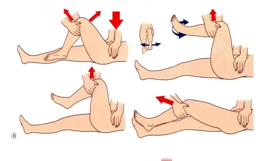 犬髋关节脱位闭合复位,髋关节脱位的闭合复位