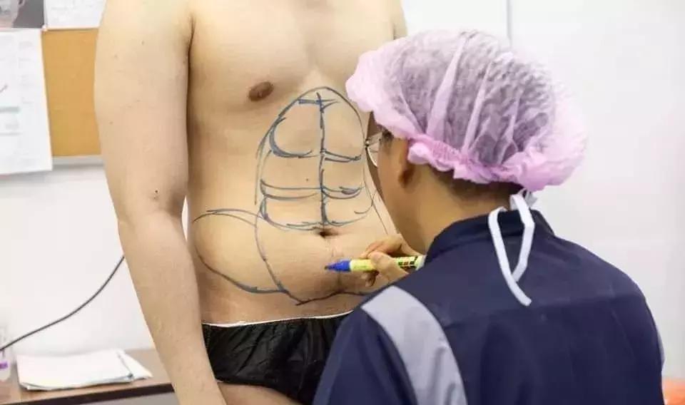 泰国网红花巨资整容30次,泰国网红花费百万整容