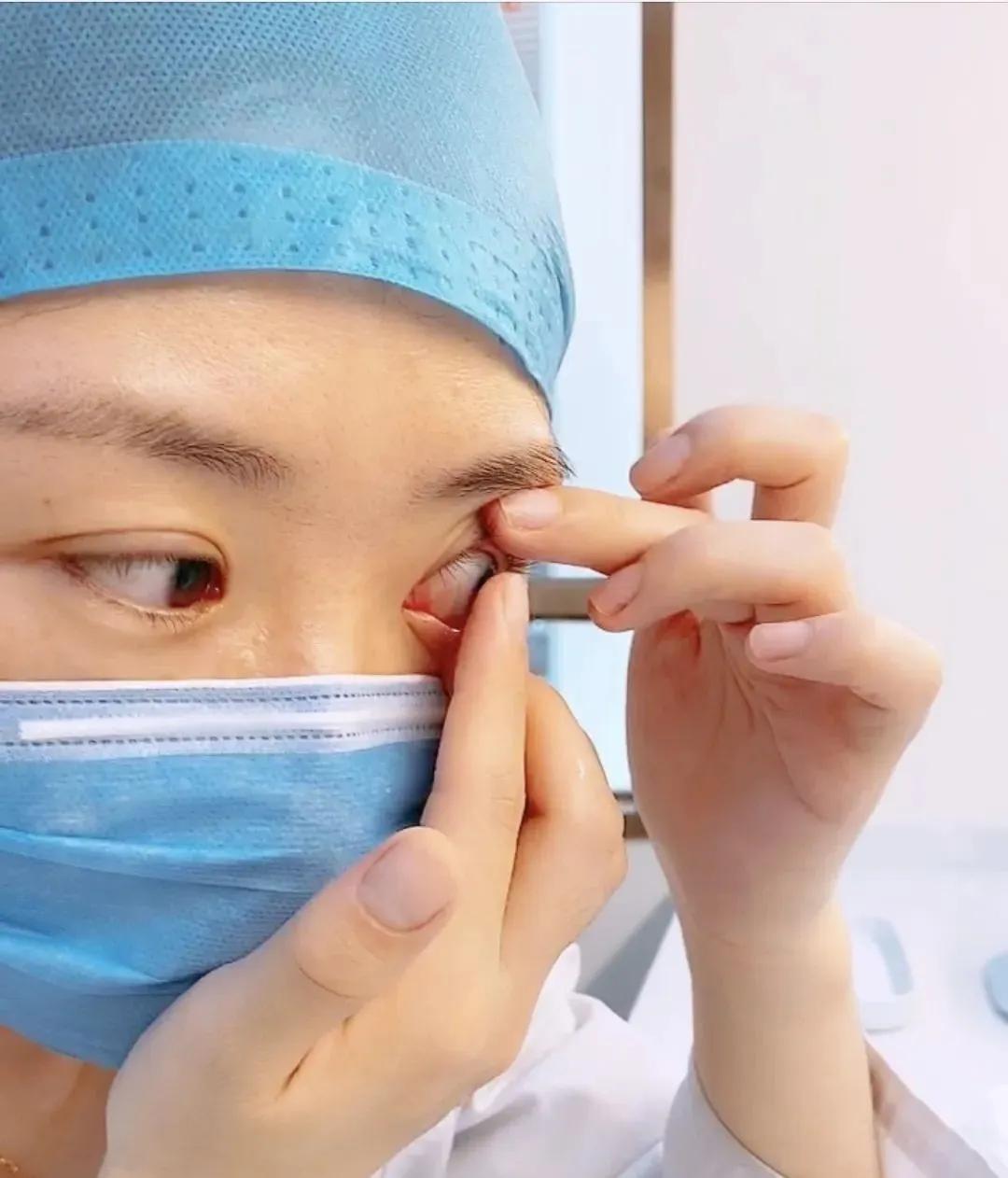 隐形眼镜怎么摘新手一次成功,隐形眼镜怎么摘都摘不下有影响吗