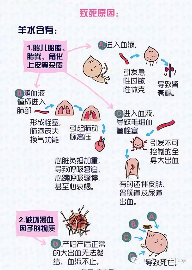 阴式分娩（自然分娩）知情同意书的专业解读