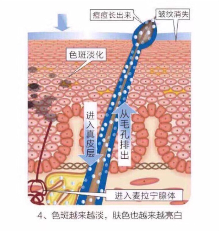 张庭活酵母面膜靠谱吗,张庭用了24年的活酵母