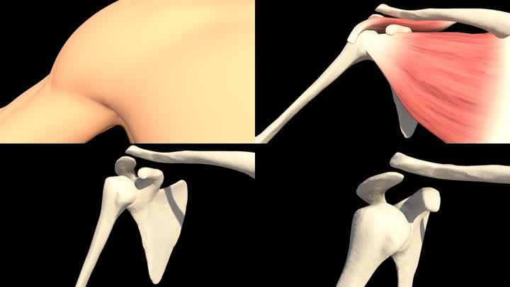 肩关节脱位患者需进行复位治疗，警惕再脱位的发生，给予制动治疗