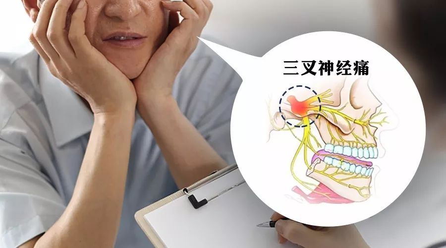 怎么分清是牙痛还是三叉神经痛,三叉神经痛和牙痛的区别是什么