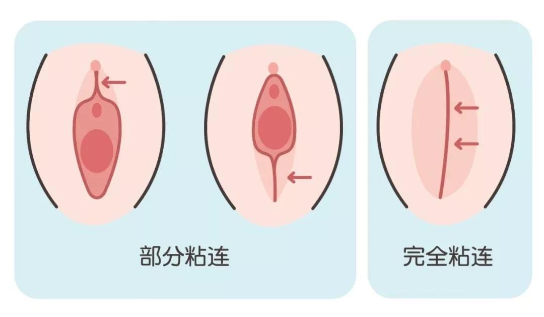 女宝护理注意事项