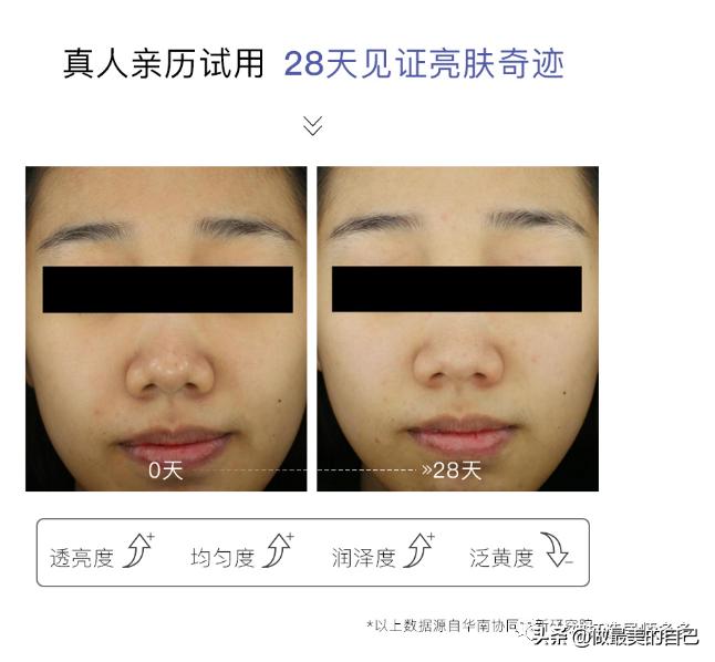 斑点暗黄肌最全的改善小技巧，都在这里