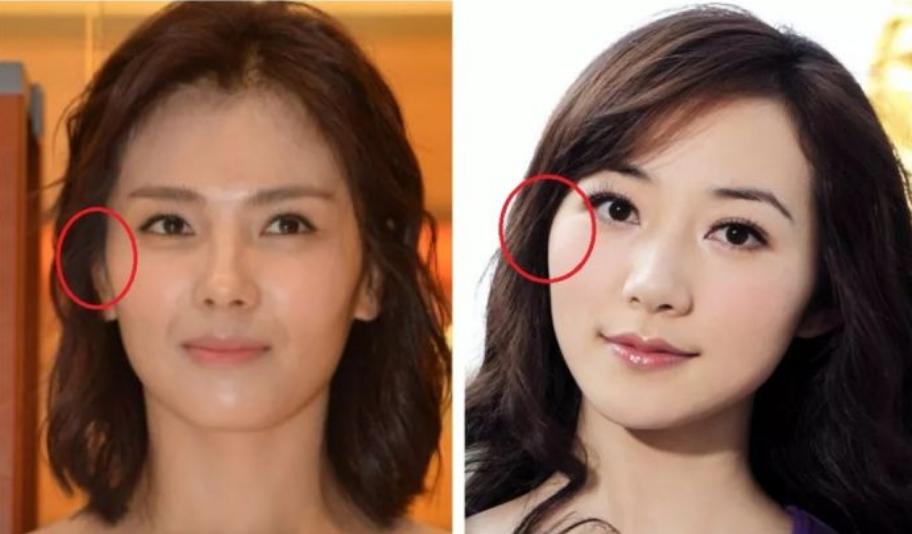 颧骨高太阳穴凹陷卷发,高颧骨太阳穴凹陷卷发