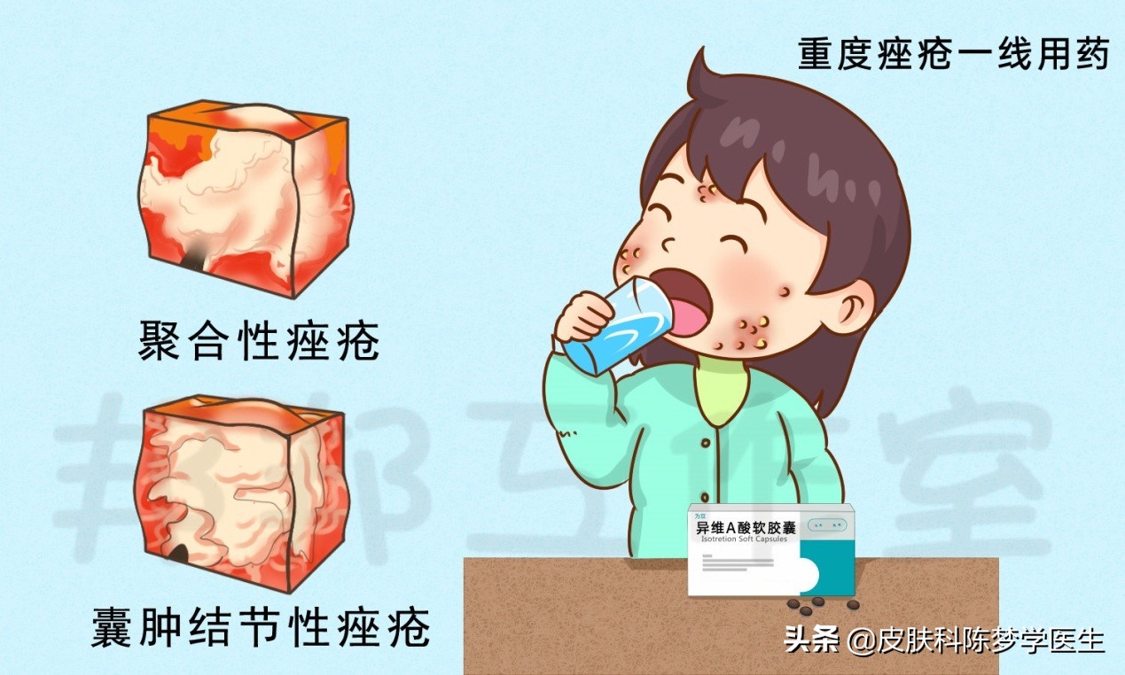 青春痘怎么快速消除不用药物,脸上起青春痘用什么中草药偏方好