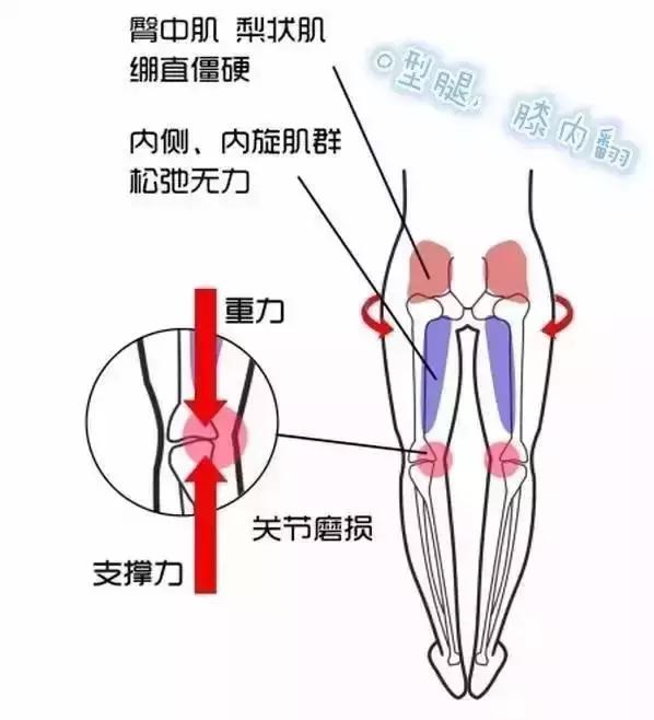 康复界名言,康复就是治愈疾病这个说法正确吗
