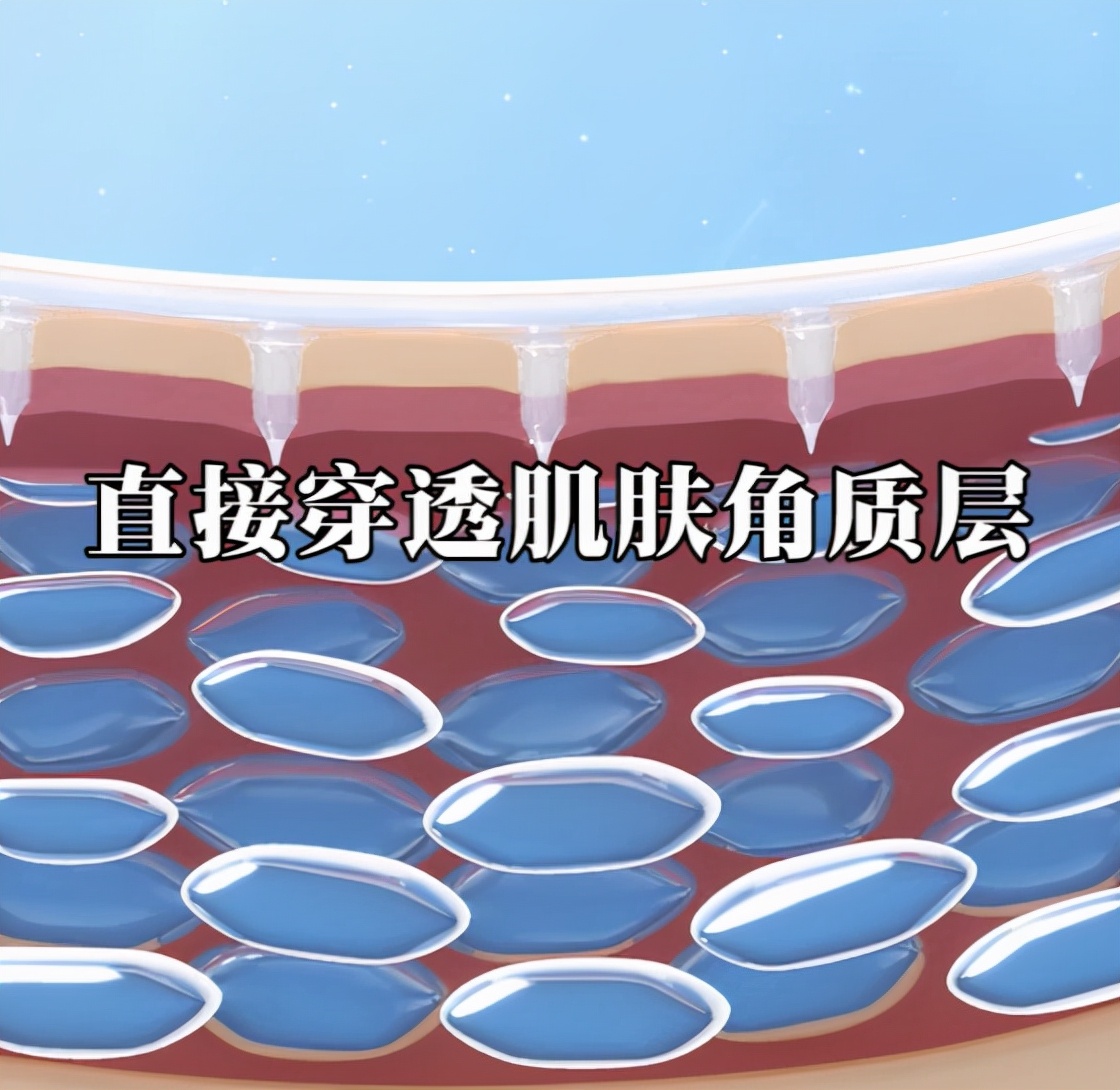 珂语祛痘印痘坑多久有效,珂语面膜测评