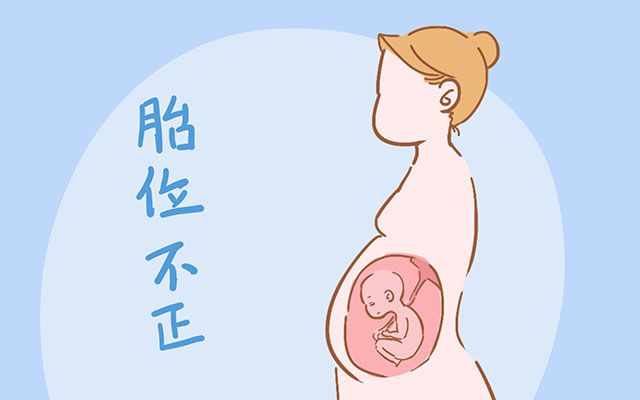 为什么医院都不建议剖腹产,为什么现在医院都建议剖腹产