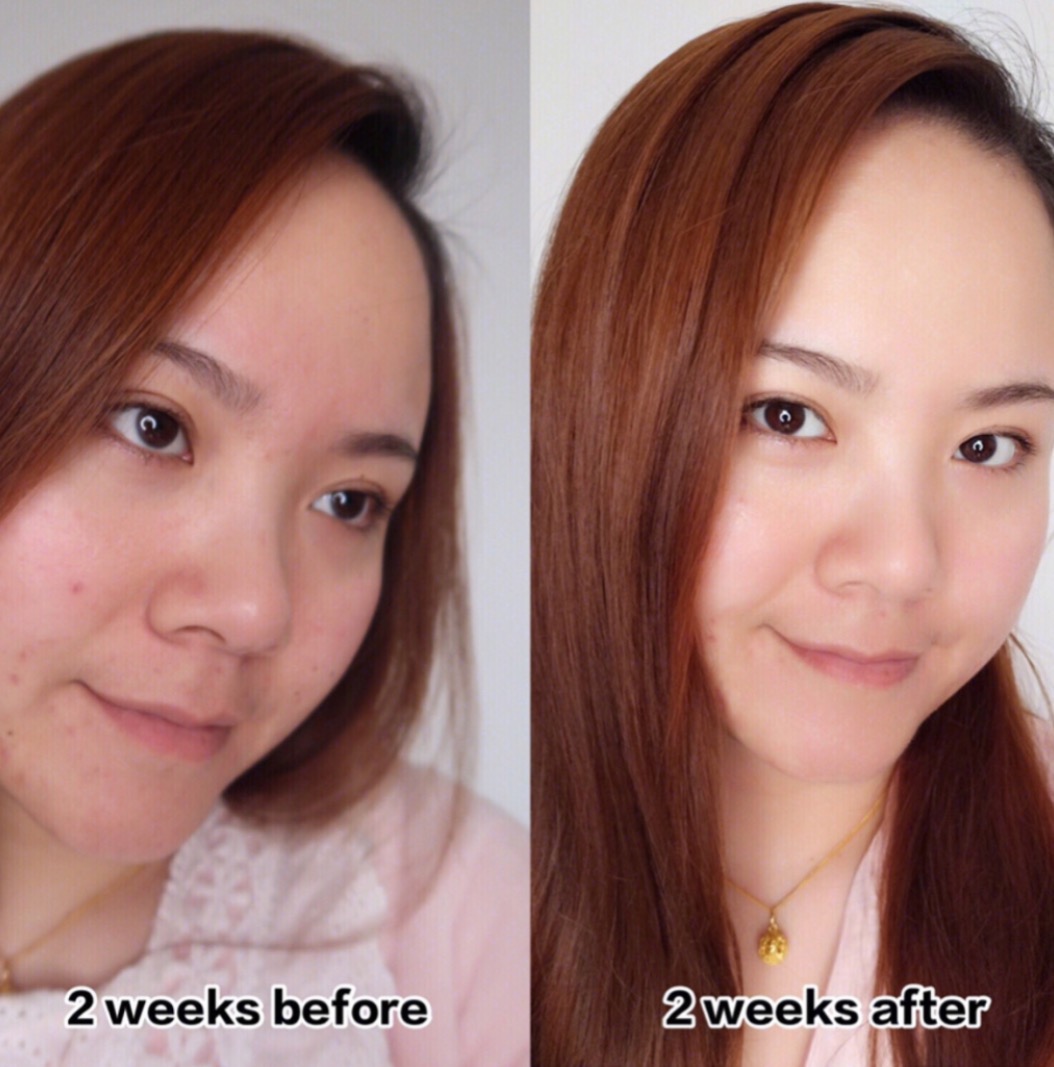 能抗氧美白的面膜,能够抗衰老的面膜