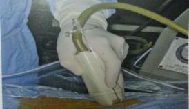 山东治疗泌尿外科比较好的医院,山东大学附属医院泌尿外科专家