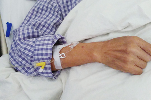 老年人骨折拆除钢钉多久恢复,老年人骨干骨折一般要多久能恢复